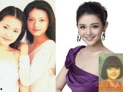 明星没有整容的,他们为何拒绝整容？